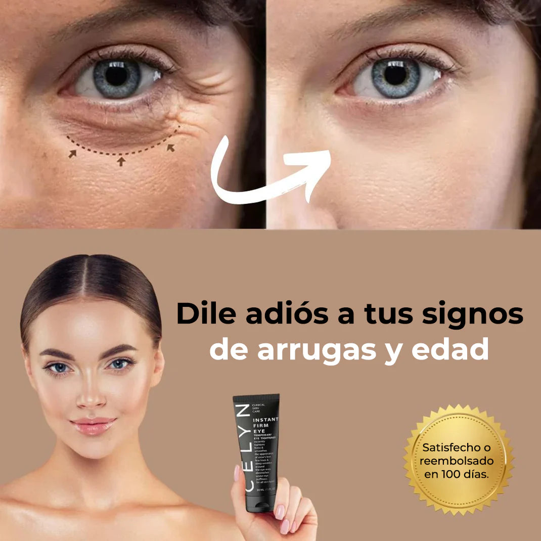 🧴Oveallgo™ CELYN  (30ml) 🌟 ¡ Crema para Ojos Rejuvenece Tu Mirada ! 🌸💖