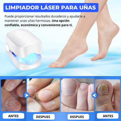 🛸Dispositivo laser LED  - Anti Hongos Uñas 👋🦠