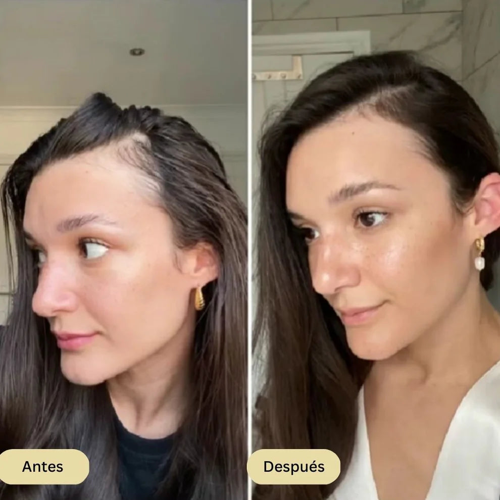 🌿 Aceite Esencial Capilar Vegano EELHOE® 60ML – Fortalece y Estimula el Crecimiento del Cabello💪🧬