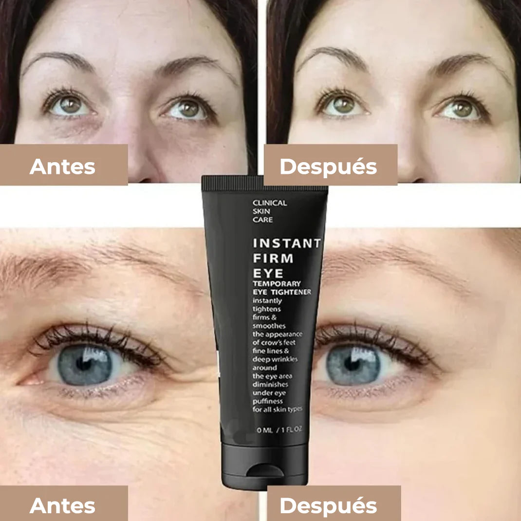 🧴Oveallgo™ CELYN  (30ml) 🌟 ¡ Crema para Ojos Rejuvenece Tu Mirada ! 🌸💖