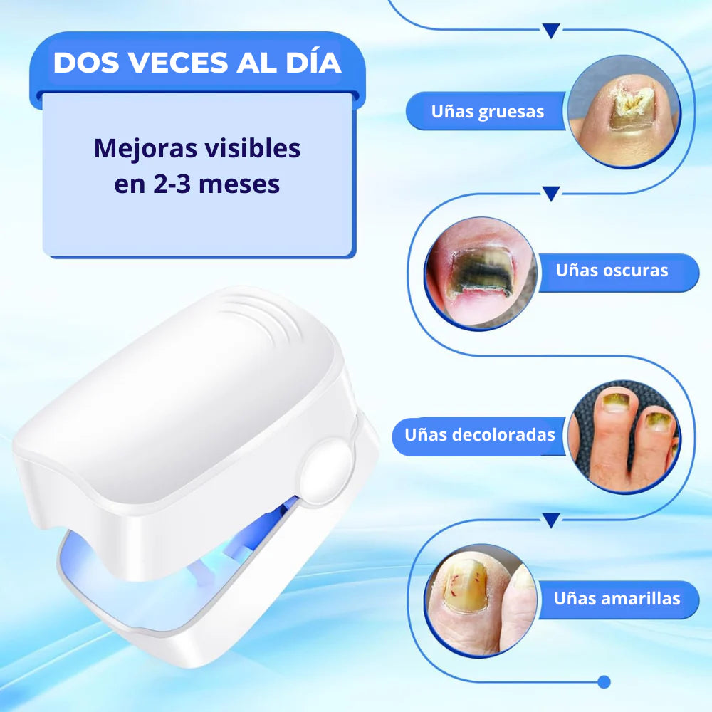 🛸Dispositivo laser LED  - Anti Hongos Uñas 👋🦠