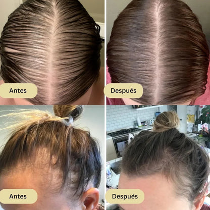 🌿 Aceite Esencial Capilar Vegano EELHOE® 60ML – Fortalece y Estimula el Crecimiento del Cabello💪🧬