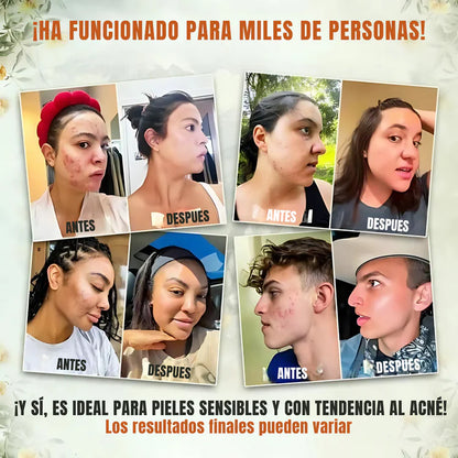 🧴✨EVIL GOODS – Bálsamo de Sebo de Res Batido🐄 y Miel🐝 de Manuka 🌻