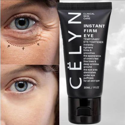 🧴Oveallgo™ CELYN  (30ml) 🌟 ¡ Crema para Ojos Rejuvenece Tu Mirada ! 🌸💖