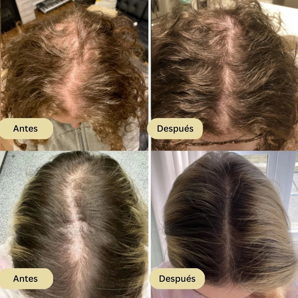 🌿 Aceite Esencial Capilar Vegano EELHOE® 60ML – Fortalece y Estimula el Crecimiento del Cabello💪🧬