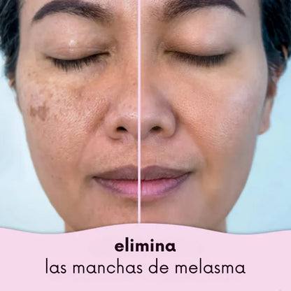 Almohadillas de cúrcuma y ácido kójico - piel radiante en menos de 2 semanas