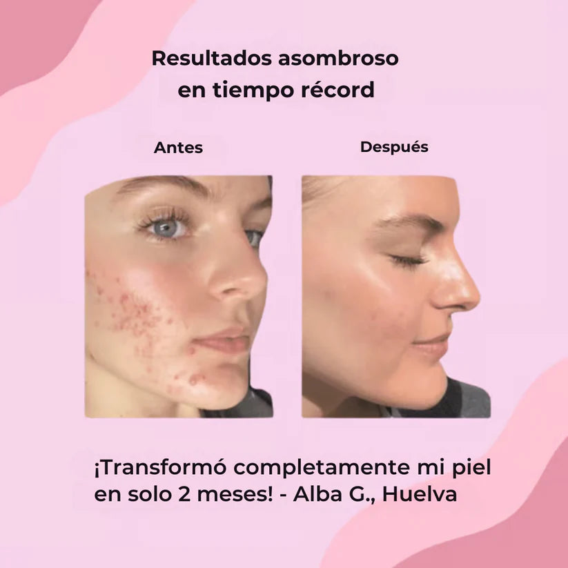 Almohadillas de cúrcuma y ácido kójico - piel radiante en menos de 2 semanas