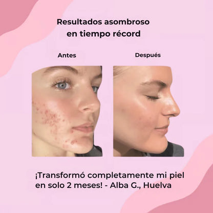 Almohadillas de cúrcuma y ácido kójico - piel radiante en menos de 2 semanas