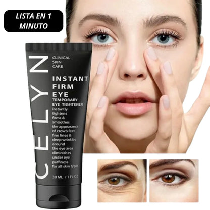 🧴Oveallgo™ CELYN  (30ml) 🌟 ¡ Crema para Ojos Rejuvenece Tu Mirada ! 🌸💖