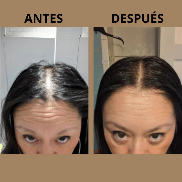 🌿 Aceite Esencial Capilar Vegano EELHOE® 60ML – Fortalece y Estimula el Crecimiento del Cabello💪🧬
