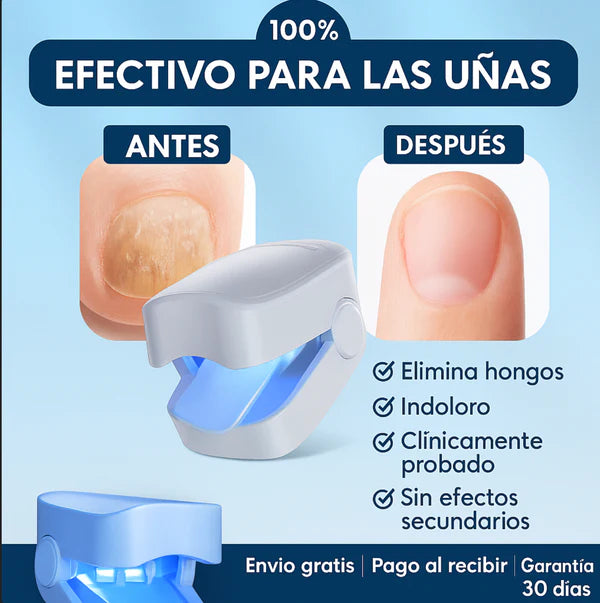 🛸Dispositivo laser LED  - Anti Hongos Uñas 👋🦠