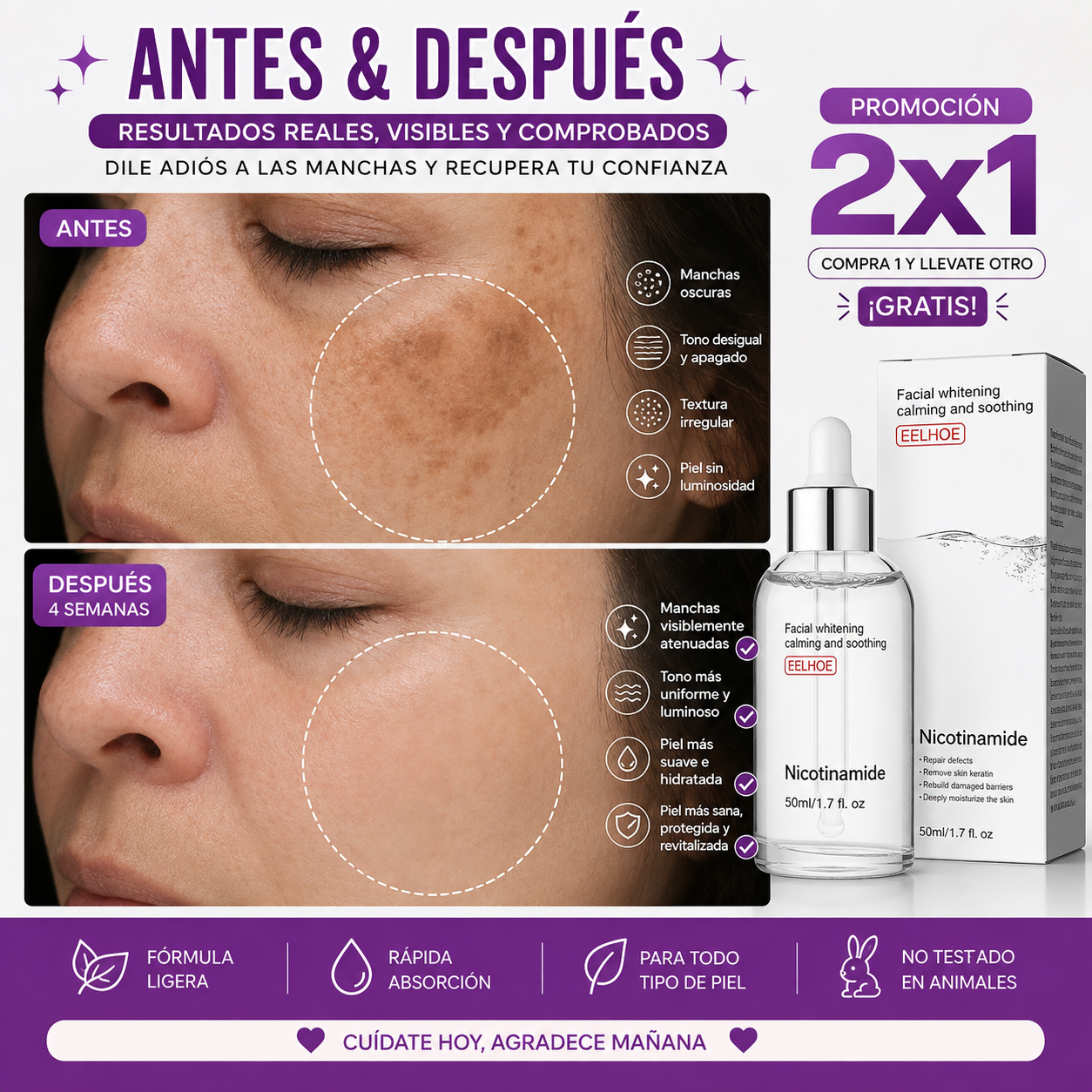 🧴Promoción 2 por 1 - Serum Facial con Nicotinamida 🧪 x 2 UNIDADES💧🌟