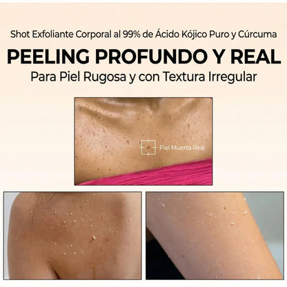 DR. MELAXIN EXFOLIANTE PEEL SHOT (Kojic Acid + Turm)