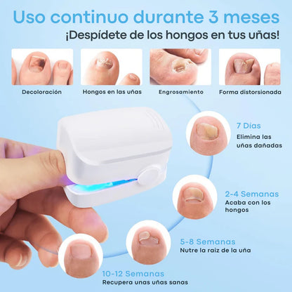 🛸Dispositivo laser LED  - Anti Hongos Uñas 👋🦠