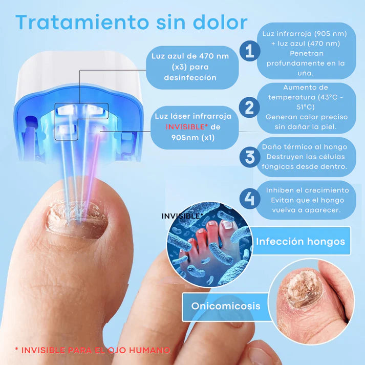 🛸Dispositivo laser LED  - Anti Hongos Uñas 👋🦠