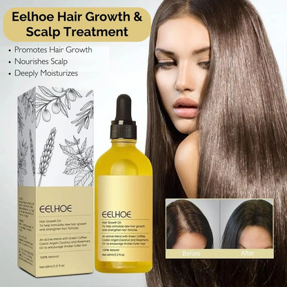 🌿 Aceite Esencial Capilar Vegano EELHOE® 60ML – Fortalece y Estimula el Crecimiento del Cabello💪🧬