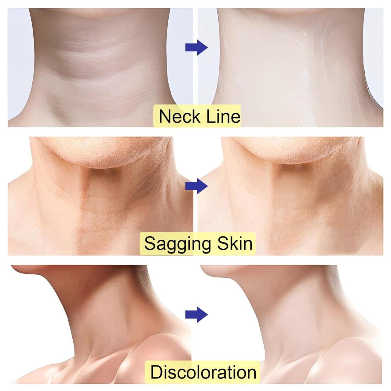 💜 Neck Cream® Reafirmante Antienvejecimiento💜
